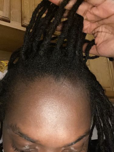 Customer photo review of Starter Locs Detox & Style Box