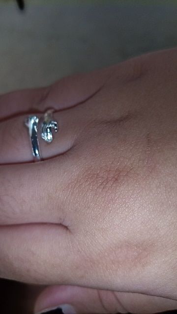 Customer photo review of Embrace | Hug Ring | 925 Sterling Silver