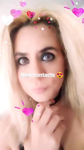 Customer photo review of Neala Pink Contact Lenses(12 months wear)