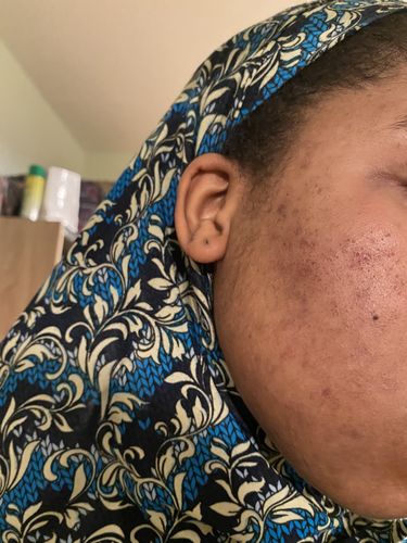 Customer photo review of SHE[A] RAW