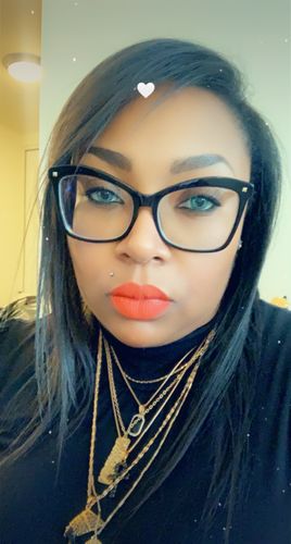 Customer photo review of Cherry Ocean Prescription Contact Lenses