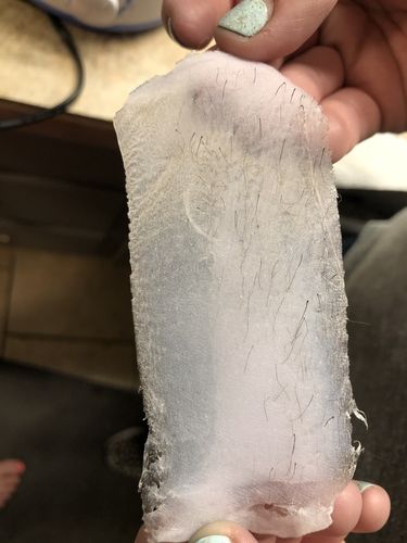 Customer photo review of At-Home Signature Series Hair Removal Wax