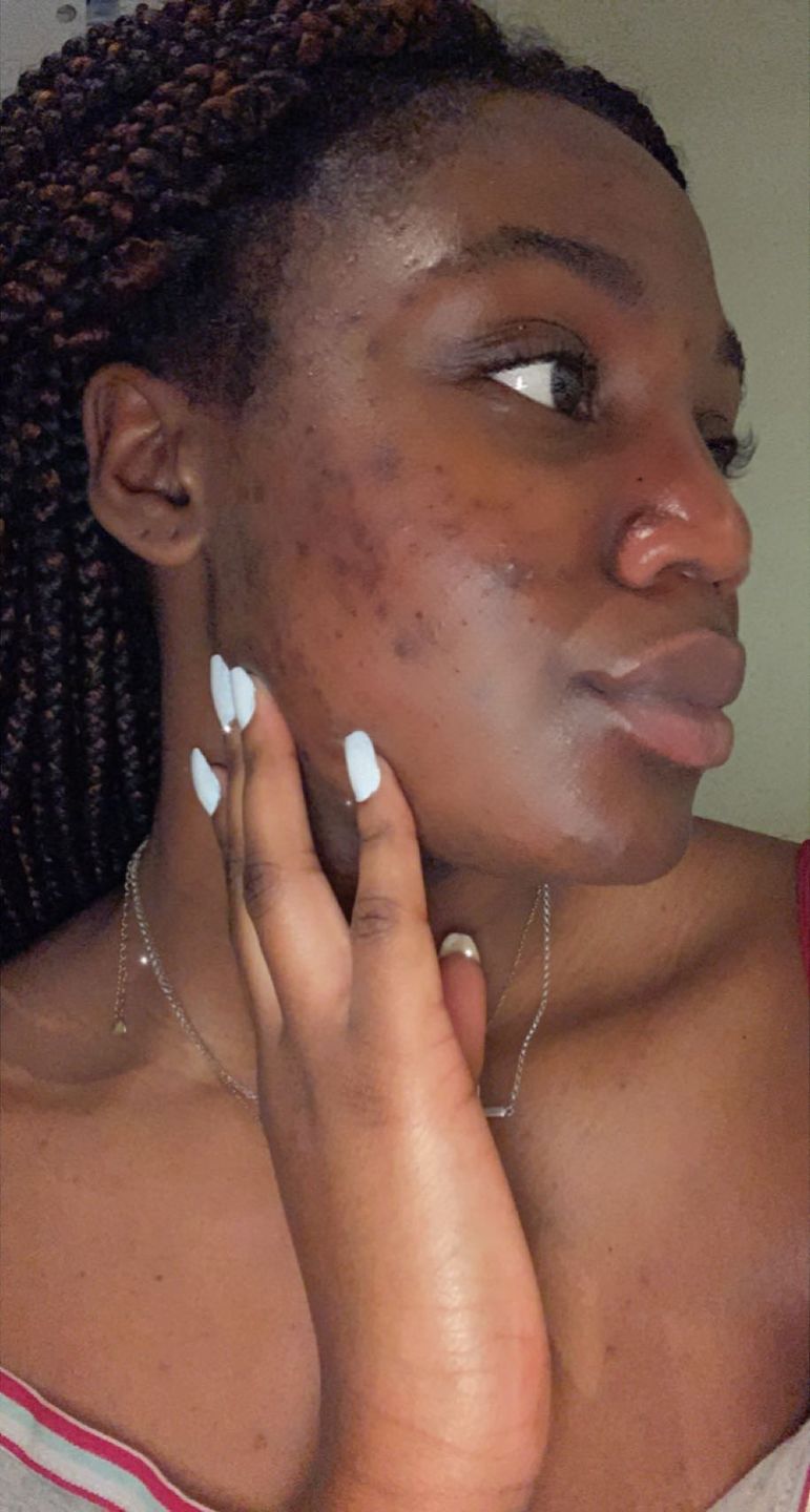 Customer photo review of HYPER G[L]O - Renewing Night Serum