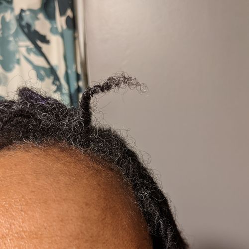 Customer photo review of Hair Growth Serum