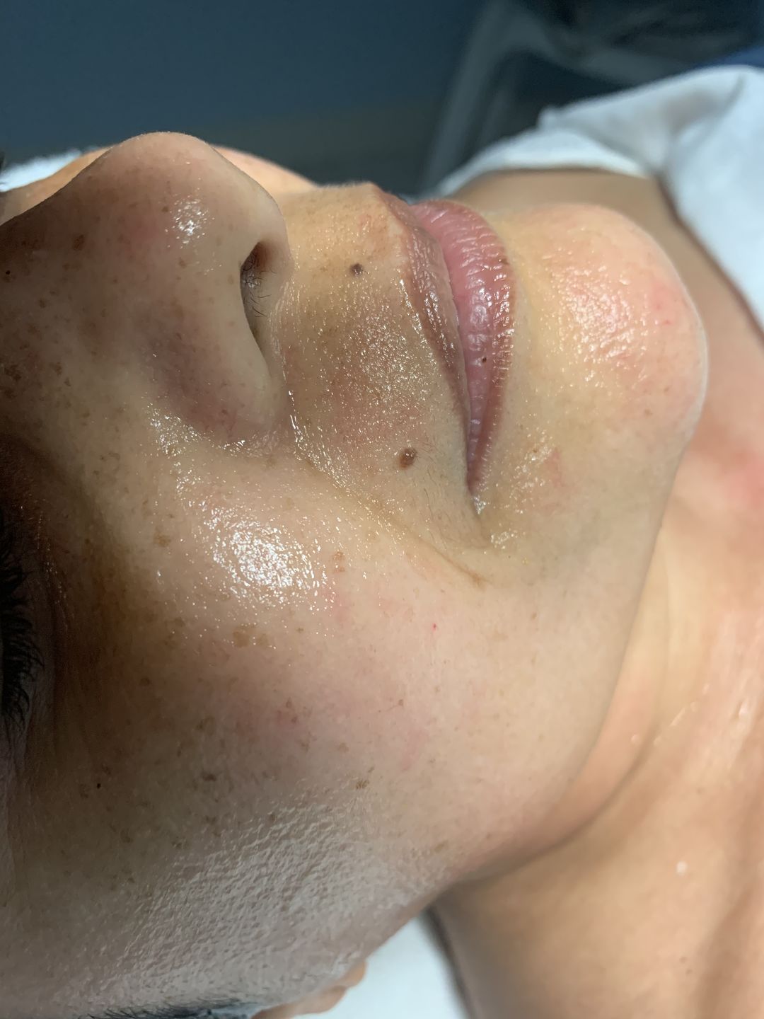 Customer photo review of ARGIRELINE COMPLEX