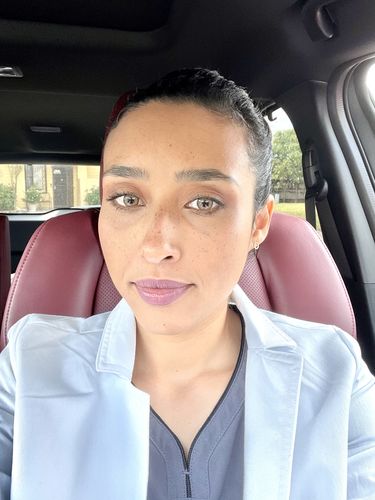 Customer photo review of Salri Brown Contact Lenses(12 months wear)