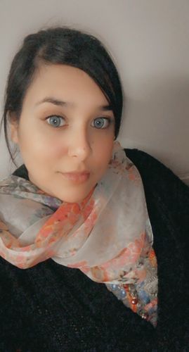 Customer photo review of Norko Blue Contact Lenses(12 months wear)