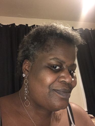 Customer photo review of Hair Regrowth Serum - Extra Strength (Large Bottle)