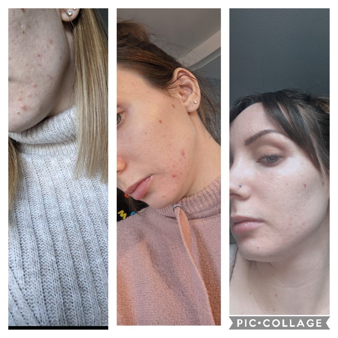 Customer photo review of Repair, Healing & Relaxing Set