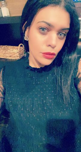 Customer photo review of [US Warehouse] Elite Snow Flake Contact Lenses