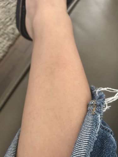 Customer photo review of At-Home Signature Series Hair Removal Wax