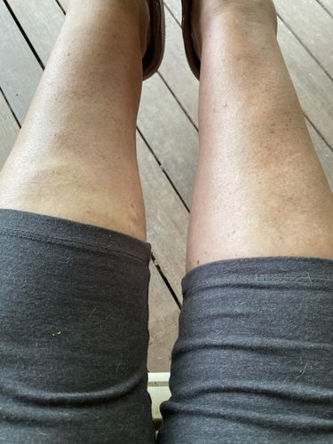 Customer photo review of LymFATics Special Bundle