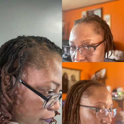 Customer photo review of Hair Growth Serum