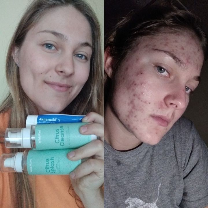 Customer photo review of Brighten Up! Vitamin C Duo