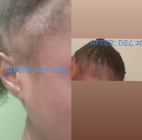 Customer photo review of Inches - Hair & Beard Oil