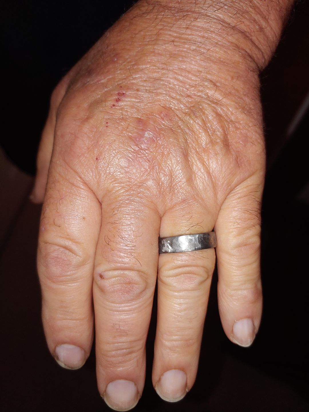 Customer photo review of Hammered Titanium and Ironwood