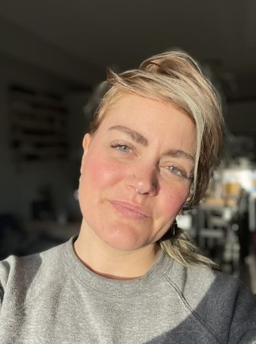 Customer photo review of Freckle Stain