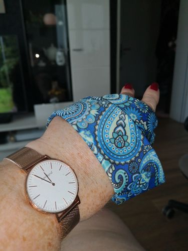 Customer photo review of World Edition Rosé Gold White