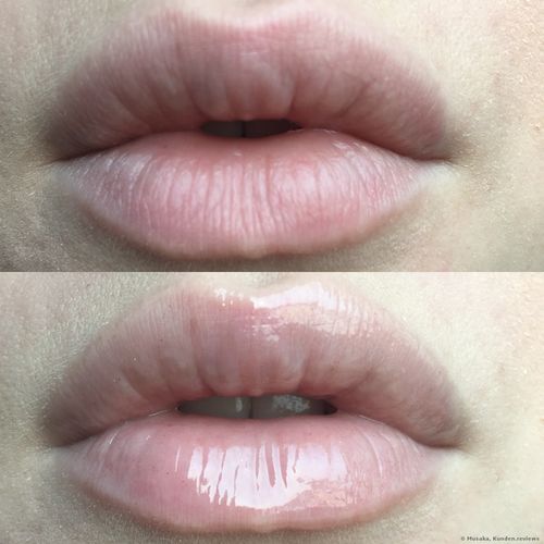 Customer photo review of LIP BOOSTING SERUM