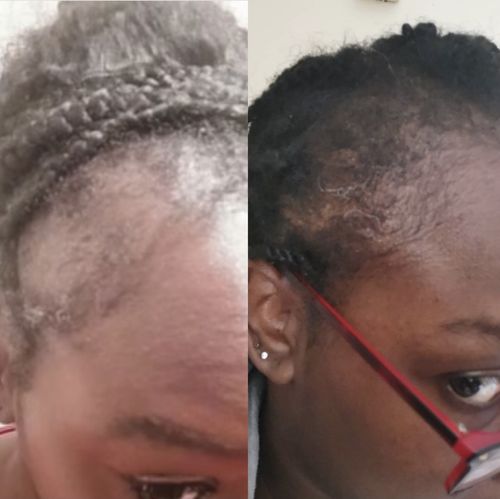 Customer photo review of Native