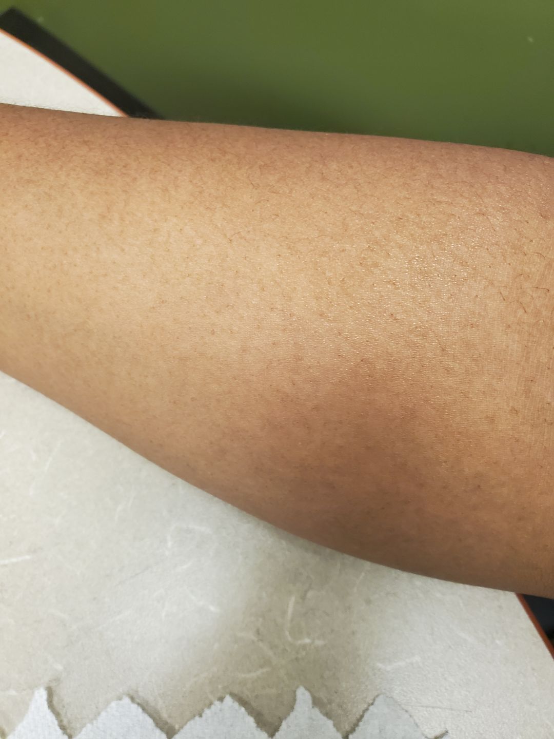 Customer photo review of Fair and White 1: Gold AHA Brightening Lotion 350ml / 11.8fl. oz