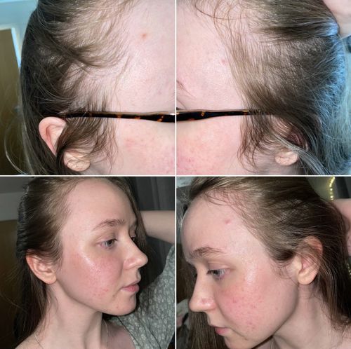 Customer photo review of The Core