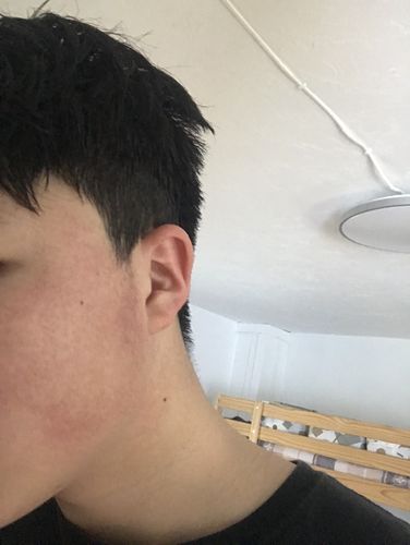 Customer photo review of Serum Concentrate Kit