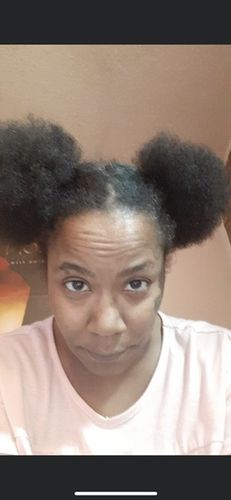 Customer photo review of (50%off)(Regrowth Hair Serum) extra strength 16oz