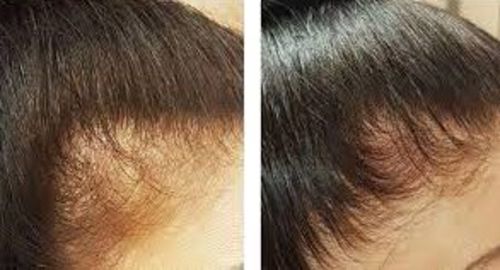 Customer photo review of Hair Growth With Argan Oil - 10 Minute Miracle - Supercharged Bundle