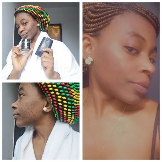 Customer photo review of SHEA DUO