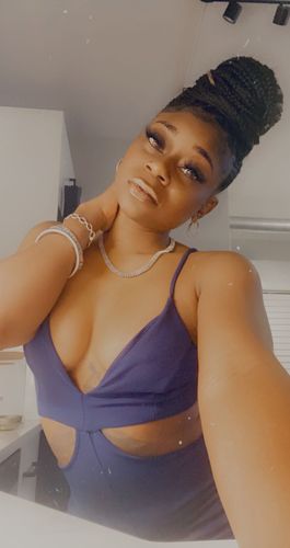 Customer photo review of [US Warehouse] Glow Radiant Hazelnut Contact Lenses