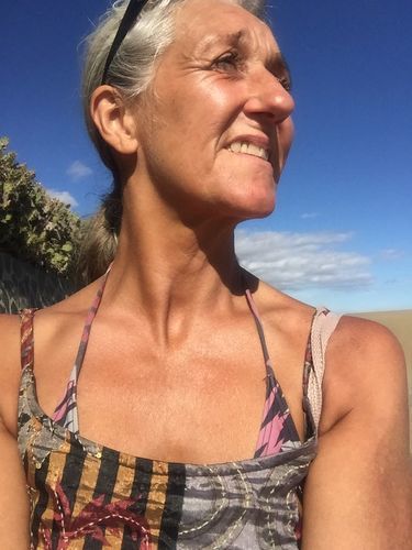 Customer photo review of Bioskin Zeoderm Skin Repair Moisturiser