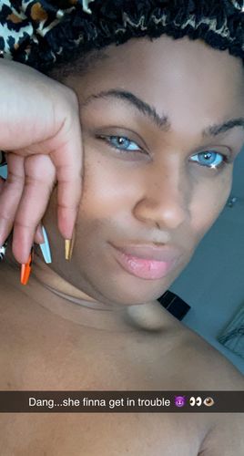 Customer photo review of SL70 Blue Contact Lenses(12 months wear)