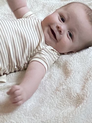 Customer photo review of Bioskin Junior Outbreak Rescue Cream