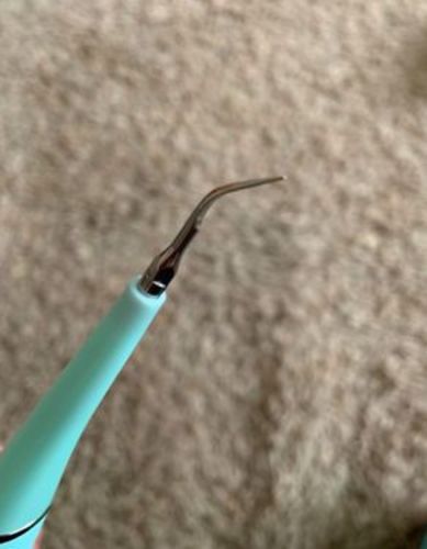 Customer photo review of SonicSmile™ Ultrasonic Tooth Cleaning Wand