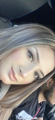 Customer photo review of Neala Green Contact Lenses(12 months wear)