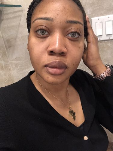 Customer photo review of Citha Hazel Contact Lenses(12 months wear)
