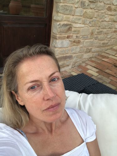 Customer photo review of Bioskin Dermaserum