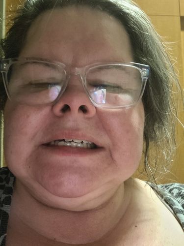 Customer photo review of Night Guard - Yearly