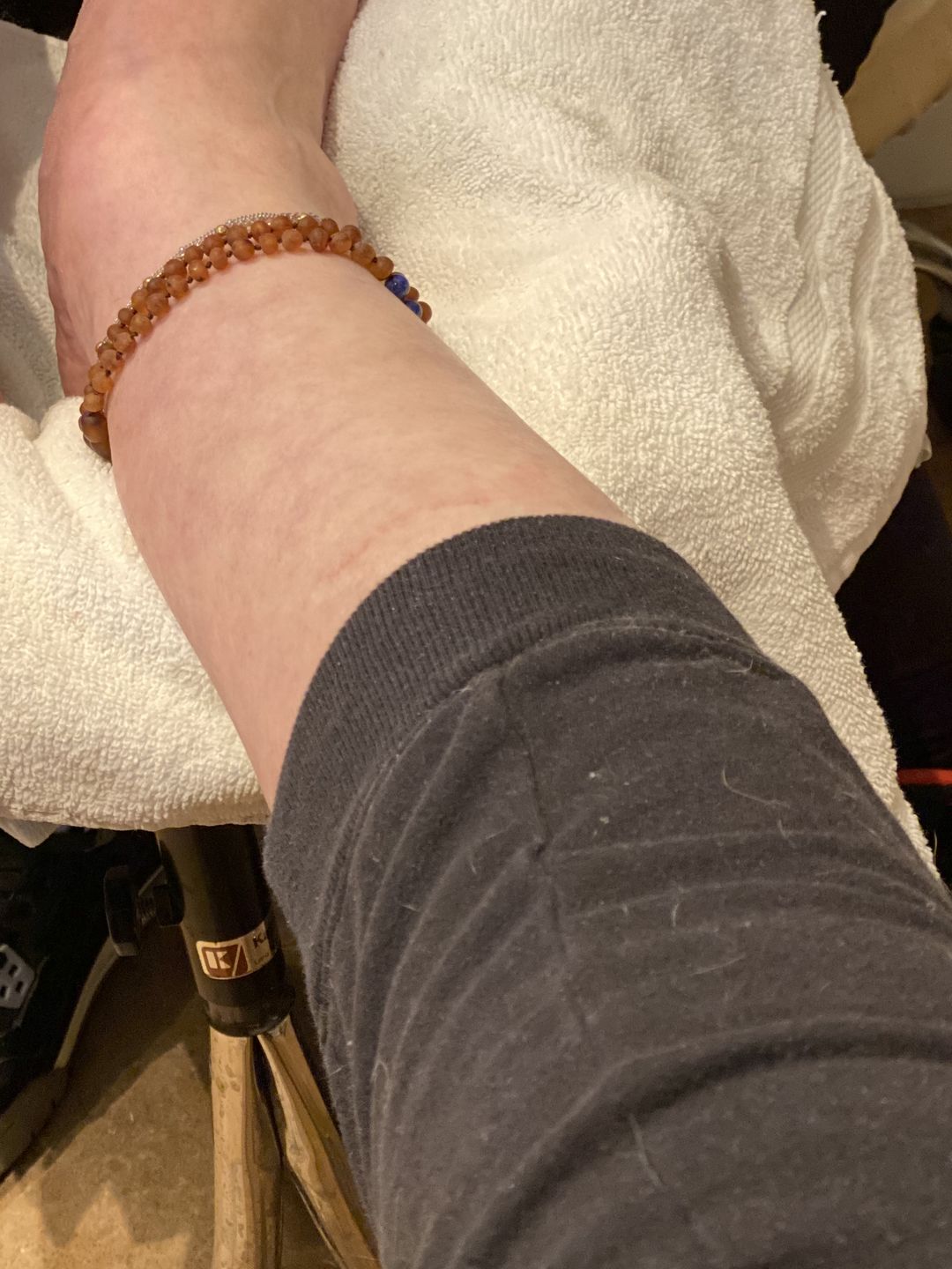 Customer photo review of Raw Cognac Amber || Anklet or Bracelet