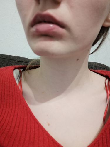 Customer photo review of LIP BOOSTING SYSTEM