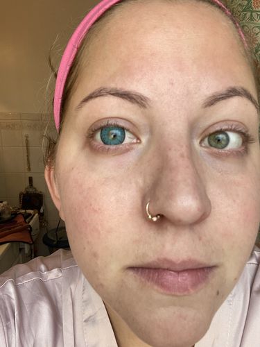 Customer photo review of [US Warehouse] [buy 2 get 2 free] Nonno Blue Prescription Contact Lenses