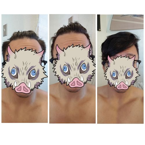 Customer photo review of Serum Concentrate Kit