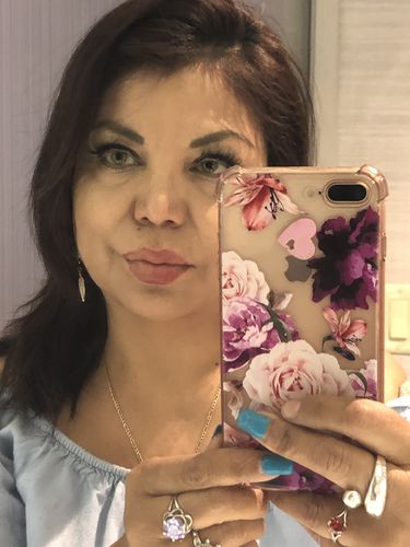 Customer photo review of Alpha Green Contact Lenses(12 months wear)