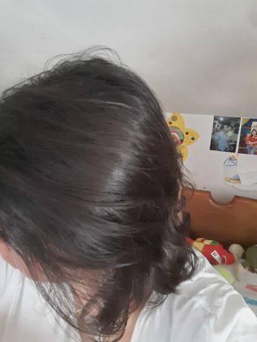 Customer photo review of Suero Anti Caída
