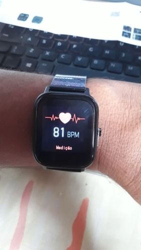 Customer photo review of Blood Pressure Watch "Pro"™