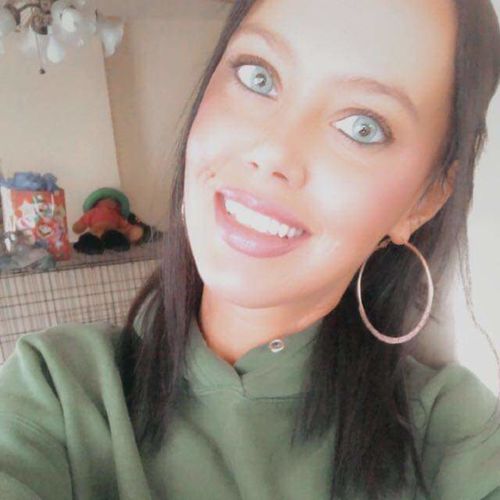 Customer photo review of Topaz Prescription Contact Lenses