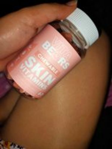 Customer photo review of Skin Vitamin Gummies