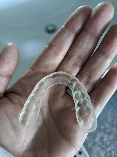 Customer photo review of Night Guard - Yearly