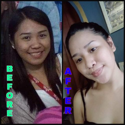 Customer photo review of Skin Vitamin Gummies